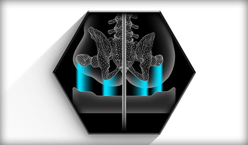 Image of the Axiom AS & ASP wheelchair cushion - Self-adjusting wheelchair cushion for pressure relief and support