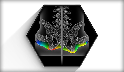 Graphic of the surface tension reduction of the Axiom AS & ASP wheelchair cushion - Self-adjusting wheelchair cushion for pressure relief and support