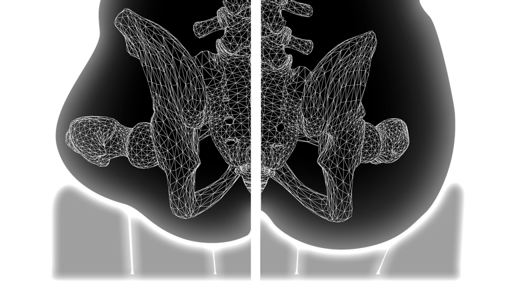 Graphic of the support on the Axiom Air LTE Wheelchair Cushion - Lightweight, air-filled wheelchair cushion designed for pressure redistribution and comfort, featuring a breathable cover.